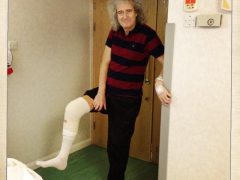 Brian after knee operation