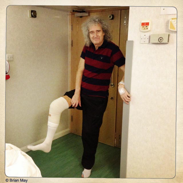 Brian after knee operation